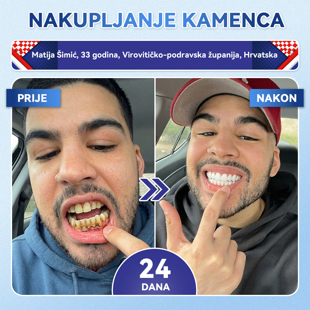 𝐺𝑙𝑖𝑚𝑚𝑒𝑟𝑙𝑦® 𝑇𝑖𝑑𝑒𝑔𝑙𝑢𝑠𝑖𝑏 𝑏𝑟𝑧𝑜𝑜𝑡𝑎𝑝𝑎𝑗𝑢ć𝑒 𝑜𝑟𝑎𝑙𝑛𝑒 𝑡𝑟𝑎𝑘𝑖𝑐𝑒 𝑧𝑎 𝑜𝑏𝑛𝑜𝑣𝑢 𝑧𝑢𝑏𝑖 𝑖 𝑑𝑒𝑠𝑛𝑖 🥑🥑