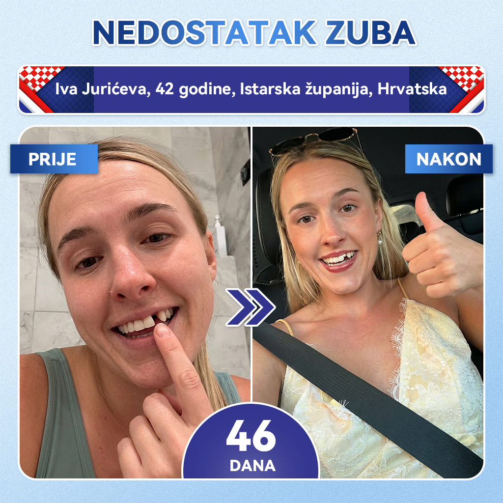 𝐺𝑙𝑖𝑚𝑚𝑒𝑟𝑙𝑦® 𝑇𝑖𝑑𝑒𝑔𝑙𝑢𝑠𝑖𝑏 𝑏𝑟𝑧𝑜𝑜𝑡𝑎𝑝𝑎𝑗𝑢ć𝑒 𝑜𝑟𝑎𝑙𝑛𝑒 𝑡𝑟𝑎𝑘𝑖𝑐𝑒 𝑧𝑎 𝑜𝑏𝑛𝑜𝑣𝑢 𝑧𝑢𝑏𝑖 𝑖 𝑑𝑒𝑠𝑛𝑖 🥑🥑