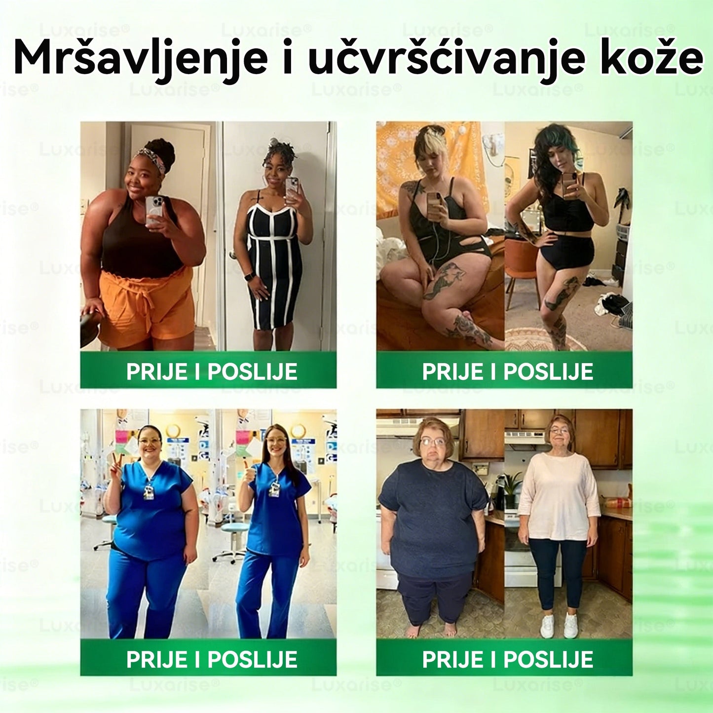 【Potpuno novi flaster PLUS】🍎🍎𝑳𝒖𝒙𝒂𝒓𝒊𝒔𝒆® 𝑴𝒐𝒓𝒊𝒏𝒈𝒂 𝑿 𝑩𝒆𝒓𝒃𝒆𝒓𝒊𝒏 10-𝑰𝒏-1 𝑵𝒂𝒑𝒓𝒆𝒅𝒂𝒏 𝑵𝒂𝒏𝒐 𝑴𝒊𝒌𝒓𝒐𝒊𝒈𝒍𝒆 𝑭𝒍𝒂𝒔𝒕𝒆𝒓 (𝑱𝒆𝒅𝒏𝒐𝒎 𝒅𝒏𝒆𝒗𝒏𝒐, 𝒗𝒊𝒅𝒍𝒋𝒊𝒗𝒆 𝒑𝒓𝒐𝒎𝒋𝒆𝒏𝒆 𝒖 7 𝒅𝒂𝒏𝒂）✅ 𝑷𝒓𝒆𝒕𝒊𝒍𝒐𝒔𝒕, 𝒅𝒊𝒋𝒂𝒃𝒆𝒕𝒆𝒔, 𝒂𝒑𝒏𝒆𝒋𝒂 𝒖 𝒔𝒏𝒖 𝒊 𝒑𝒓𝒐𝒃𝒍𝒆𝒎𝒊 𝒔𝒂 𝒛𝒈𝒍𝒐𝒃𝒐𝒗𝒊𝒎𝒂